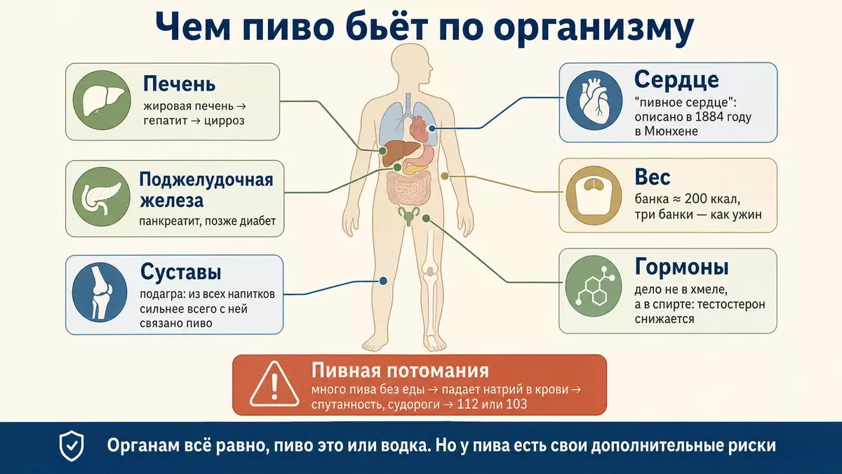 Последствия пивного алкоголизма: печень, поджелудочная железа, сердце, подагра, лишний вес, гормональные нарушения и падение натрия в крови
